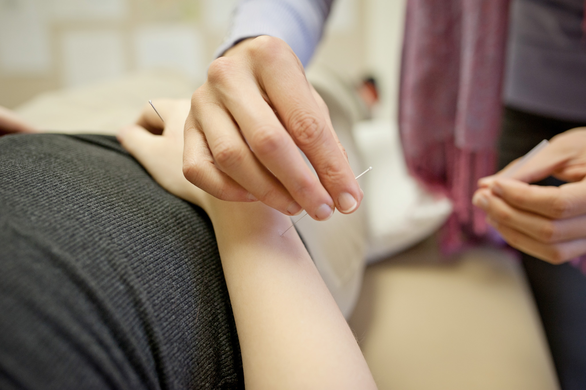 Dr. Lisa places acupuncture needles into a patient’s forearm.